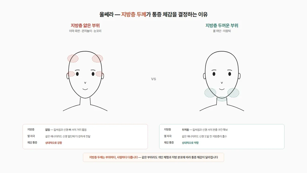 강남 피부과 울쎄라 부위별 지방층 두께 통증 차이 의학설명