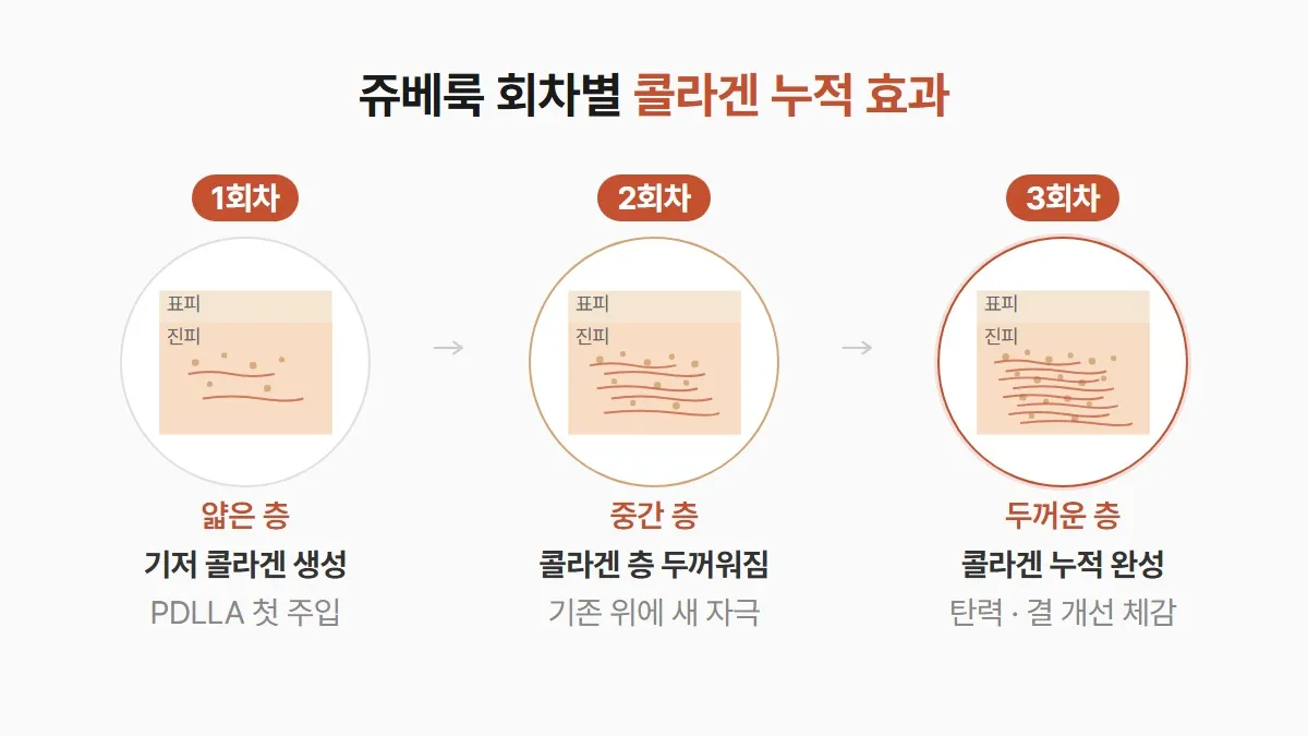 강남 피부과 쥬베룩 회차별 콜라겐 누적 효과
