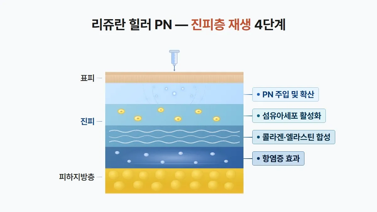 강남 피부과 리쥬란 힐러 PN 진피층 작용 원리