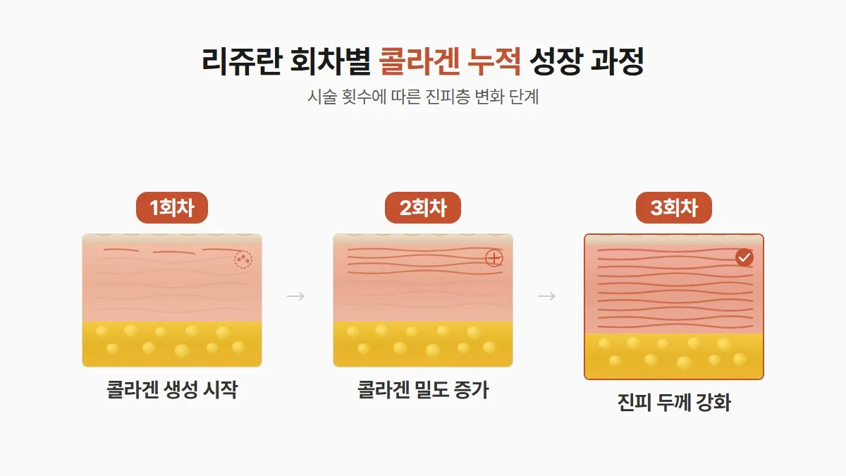 강남 피부과 리쥬란 회차별 효과 누적 과정