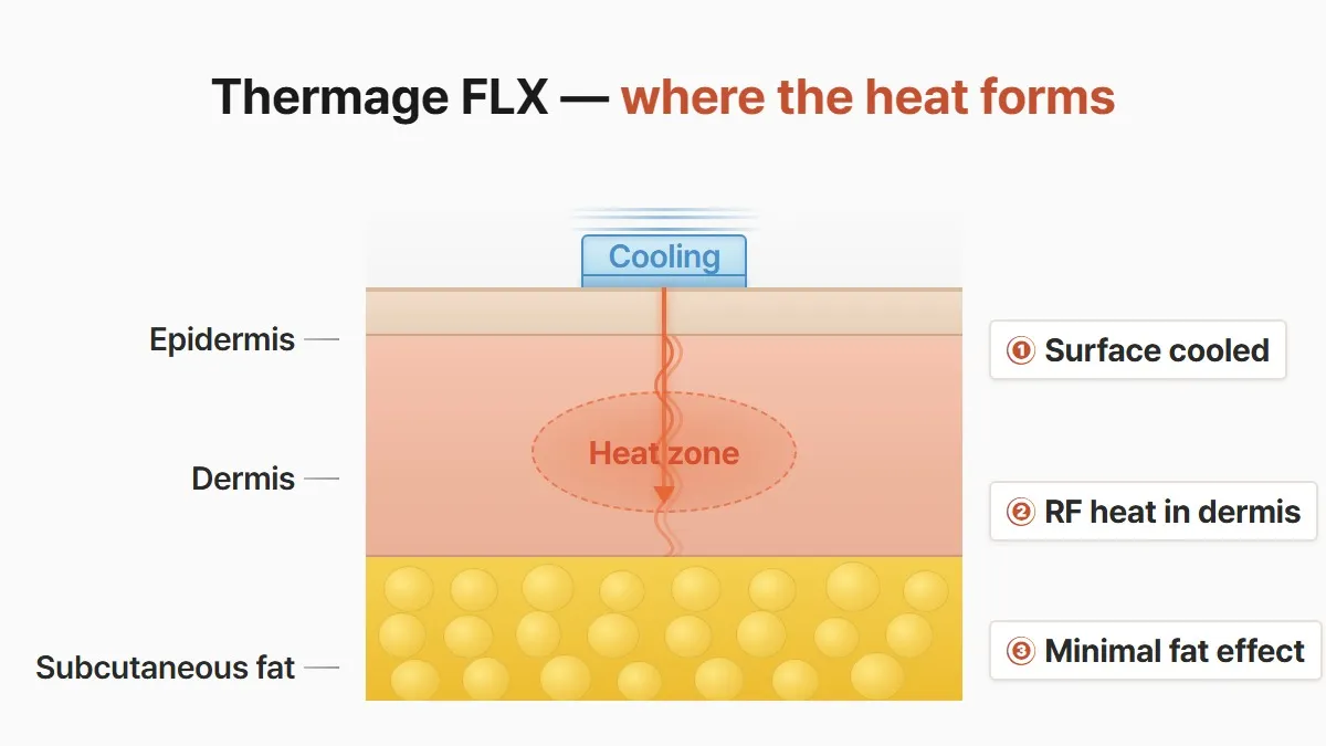 Thermage FLX heat depth and surface cooling