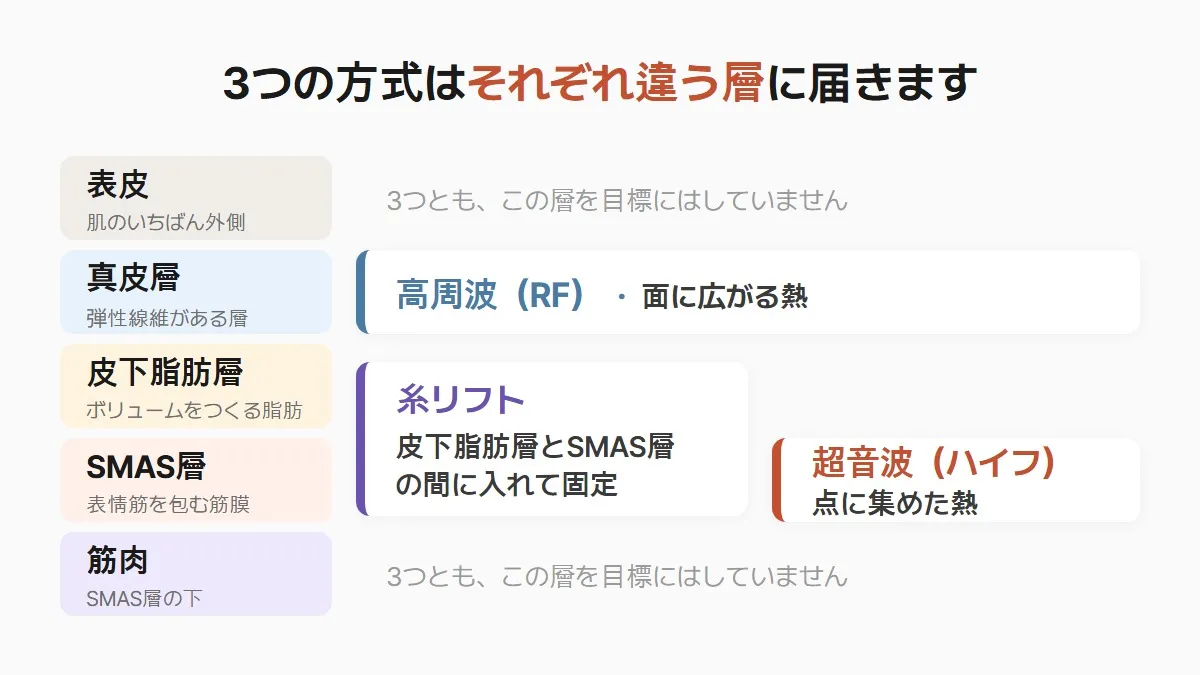 韓国のリフトアップ、超音波・高周波・糸リフトで選び方が変わります