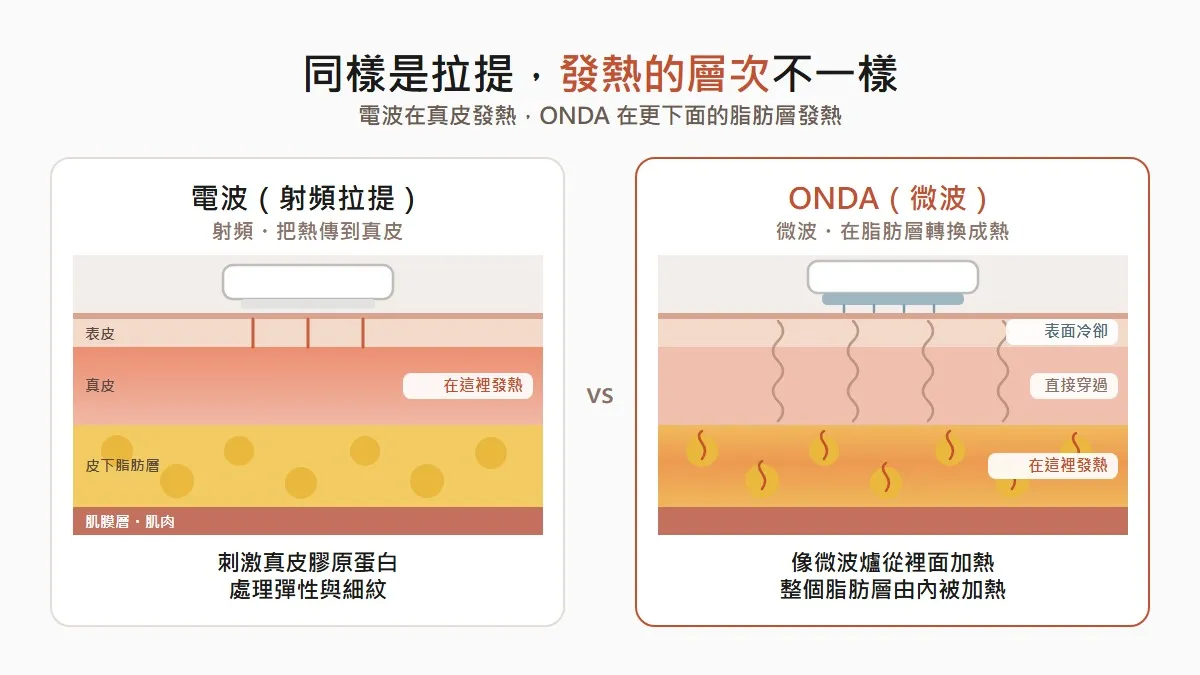 韓國ONDA與電波拉提作用層的差異
