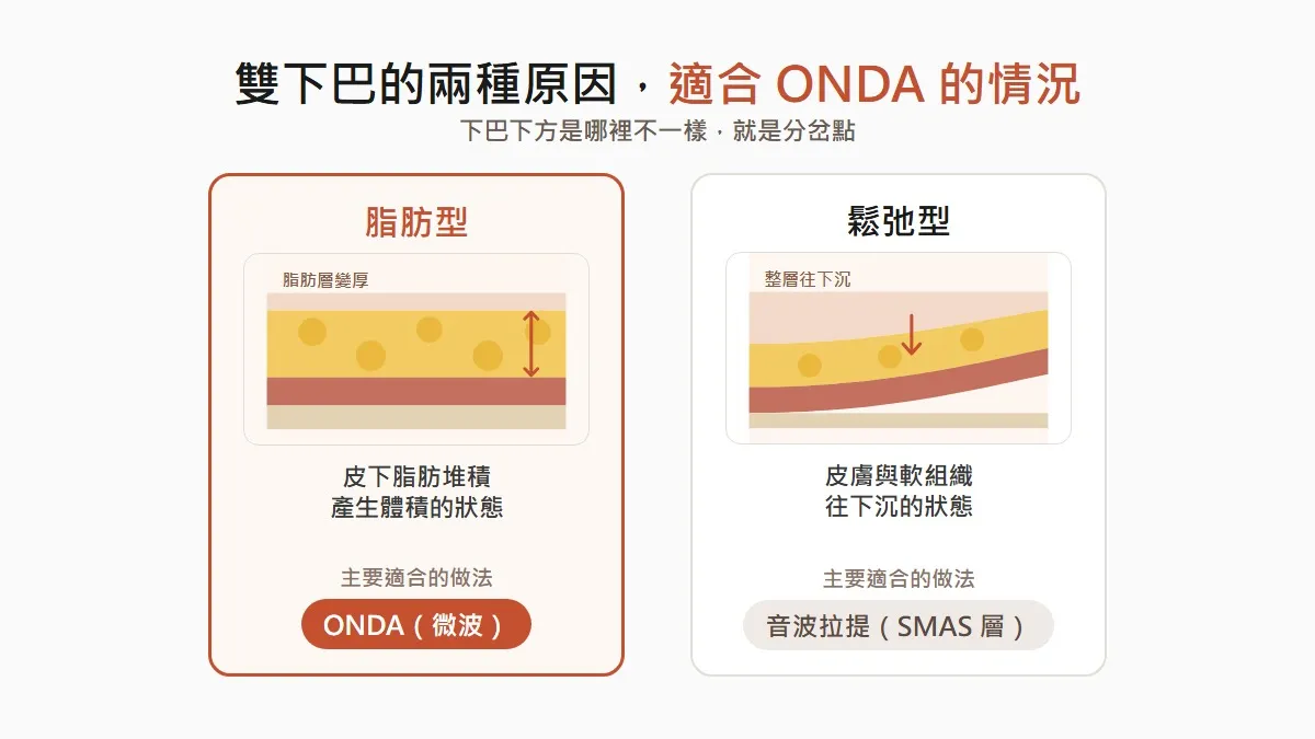 在韓國做 ONDA 拉提前，要先確認什麼？