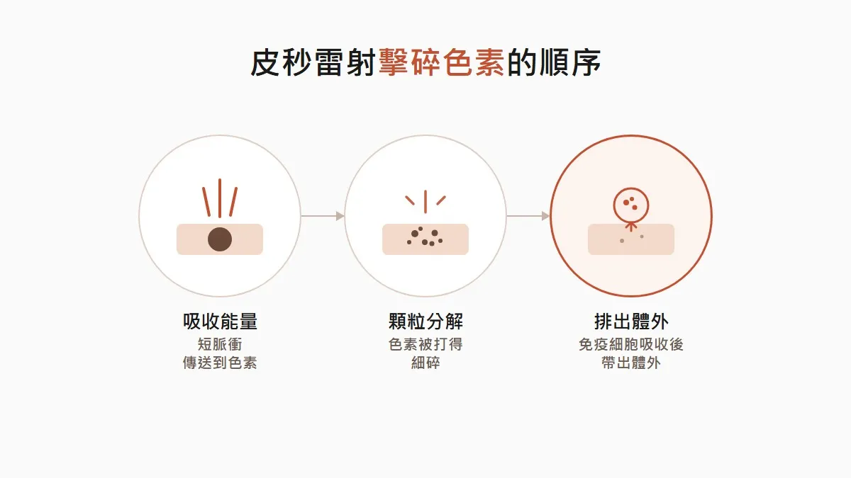 首爾皮秒擊碎色素的順序