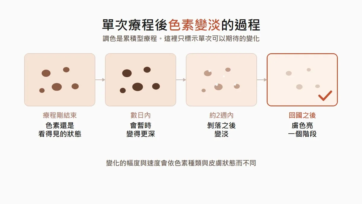 首爾皮秒調色單次後色素變淡的過程