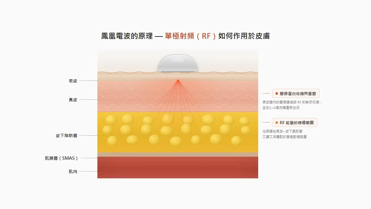 韓國鳳凰電波的電波如何作用於真皮