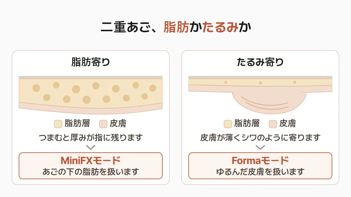 韓国のインモード、二重あごは脂肪とたるみを分けて見ます