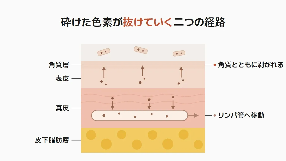 韓国のピコトーニング 砕けた色素が抜ける二つの経路