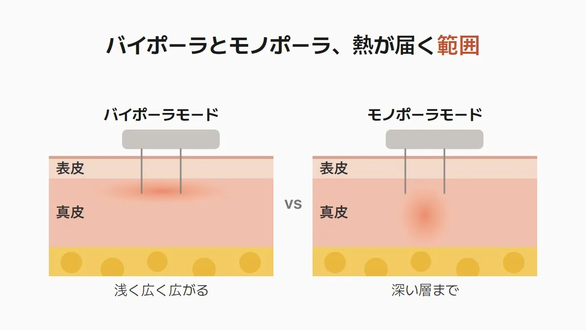 韓国のポテンツァ バイポーラとモノポーラの届く範囲