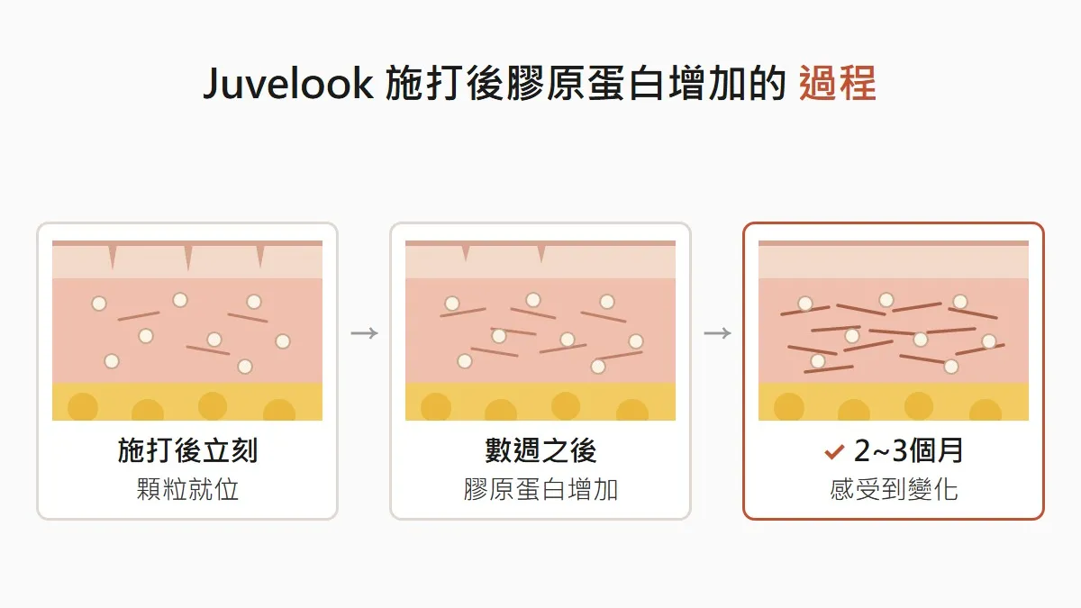 韓國 Juvelook 施打後膠原蛋白增加的過程