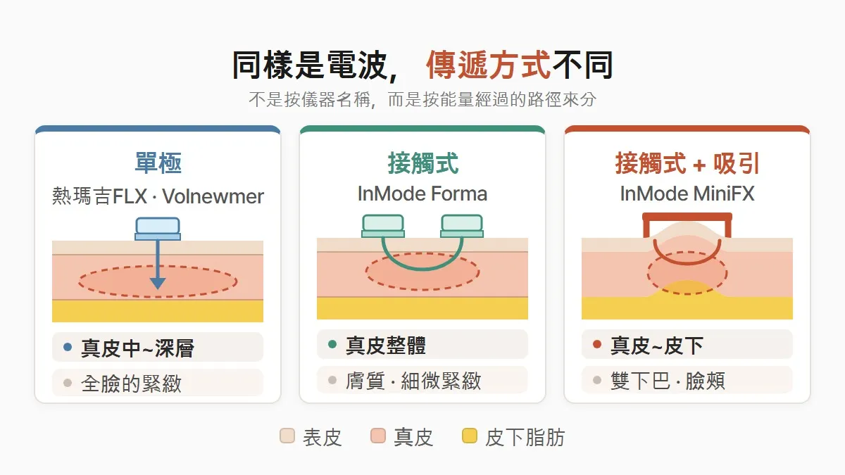 韓國電波拉提診所推薦，熱瑪吉・Volnewmer・InMode 種類比較