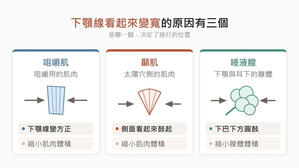 首爾肉毒下顎線變寬的三個原因