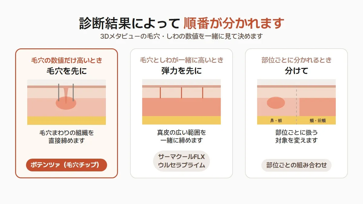 韓国のたるみ毛穴 診断結果で分かれる順番