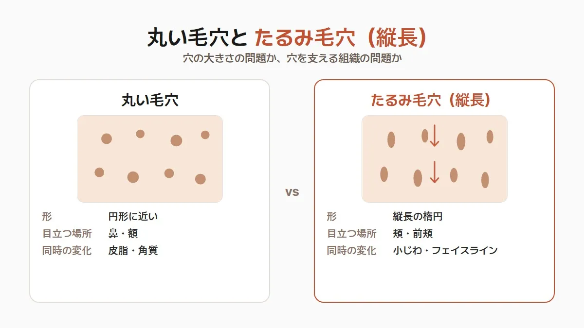 韓国の丸い毛穴とたるみ毛穴